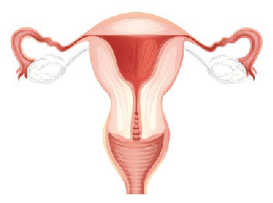 How to get pregnant with blocked fallopian tubes?
